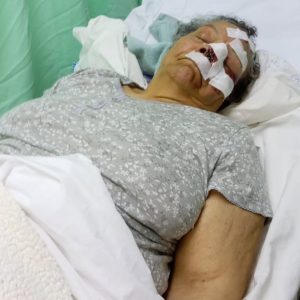 Lanzan peñón desde puente y hieren gravemente a una señora de 79 años